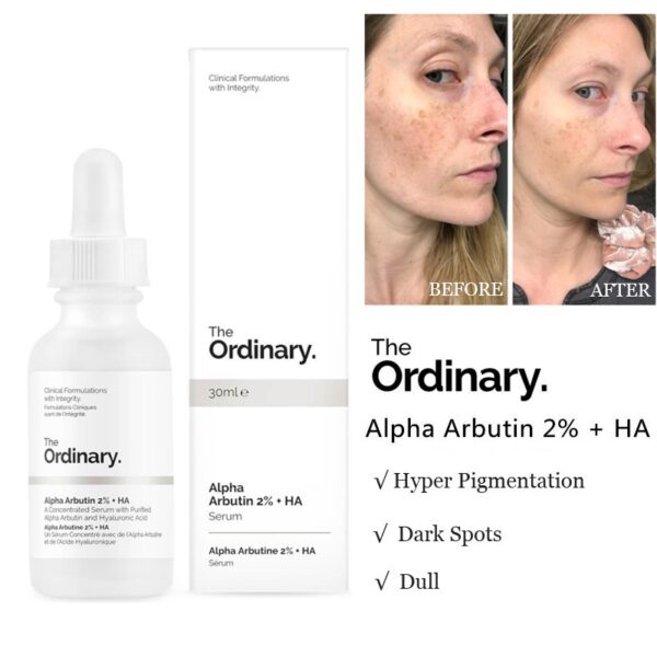 97583b0165f9ad44df8646e7575c0bbd.jpg (Bill Mỹ) - Trắng da mờ thâm Alpha Arbutin 2% + HA 30ml - The Ordinary
