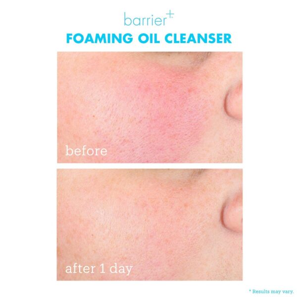 Sữa rửa mặt thải độc SKINFIX Barrier+ Foaming Clay Cleanser 30ml