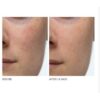 f7f595236574f33e117f6ba55a9a6fb2.jpg Tinh chất chống nhăn Serum Peter Thomas Roth Retinol Fusion PM Night Serum
