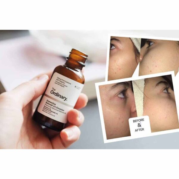 vn-11134207-7r98o-lubnq4yy75svb9.jpg Bill sephora US - Tinh Chất Chống Lão Hóa The Ordinary Granactive Retinoid 2% Emulsion